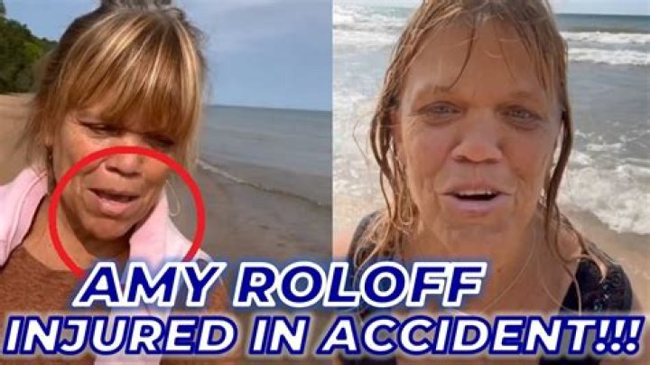 Amy Roloff's Shocking Accident: Details And Recovery