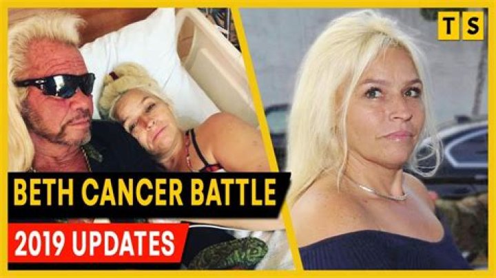 Beth Chapman Cancer Updates, Net Worth, Husband, Married, Divorce, Bio, Now