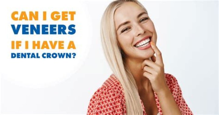 Can I get veneers if I have missing teeth?