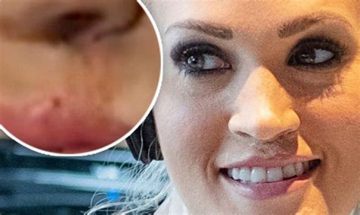 Carrie Underwoods Lip Scar Is Visible In Latest Close-Up Selfie Hollywood Life |