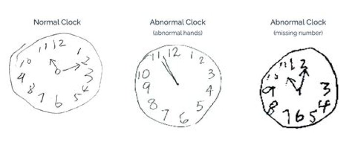 Discover Normal CDT Levels: Understanding Your Test Results