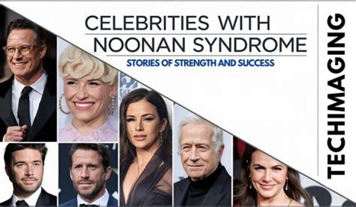 Celebrities You Didn't Know Had Noonan Syndrome