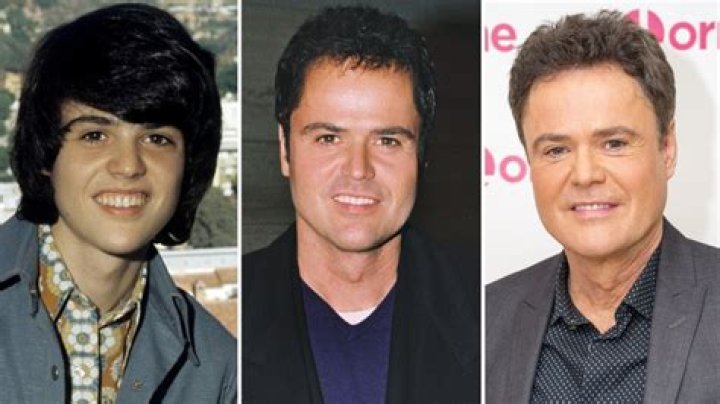 Donny Osmond's Plastic Surgery Journey Explored