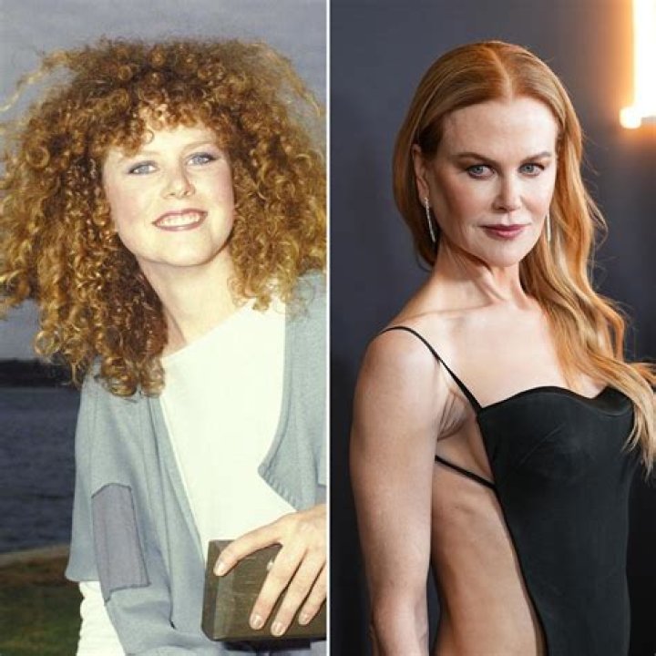 Did Nicole Kidman Secretly Undergo Plastic Surgery To Maintain Her Youthful Appearance?