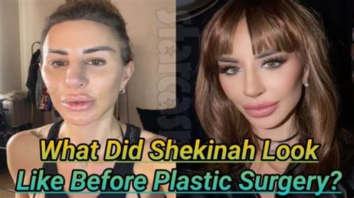 Did Shekinah Jo Undergo Plastic Surgery? Her Net Worth, IG And Everything To Know