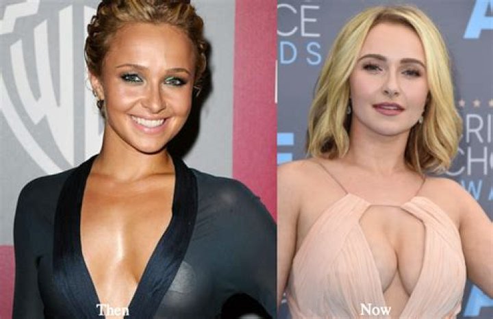 All Your Questions Answered: Hayden Panettiere's Plastic Surgery Journey
