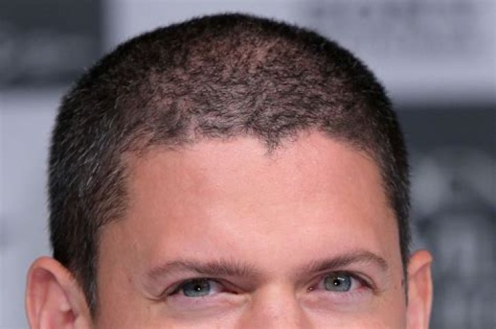 Is Wentworth Miller Bald? Health Update And Hair Loss Journey