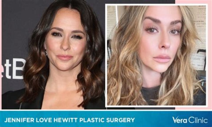 Jennifer Love Hewitt's Nose Plastic Surgery Rumors Exposed
