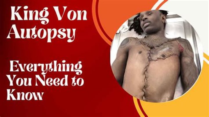 Uncovering The Hidden Truths: King Von's Autopsy Unveiled