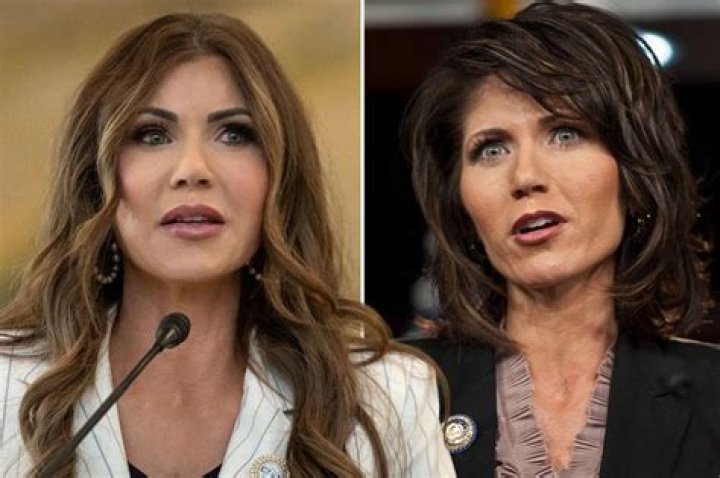 The Startling Transformation: Before And After Kristi Noem's Plastic Surgery