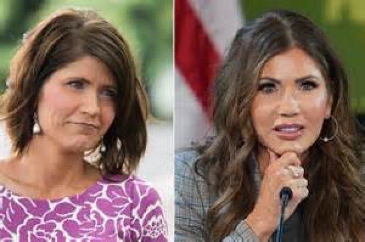 The Unveiled Truth: Kristi Noem's Cosmetic Enhancements