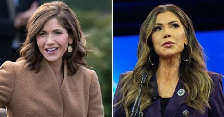 Unveiling The Truth: Kristi Noem's Plastic Surgery Journey