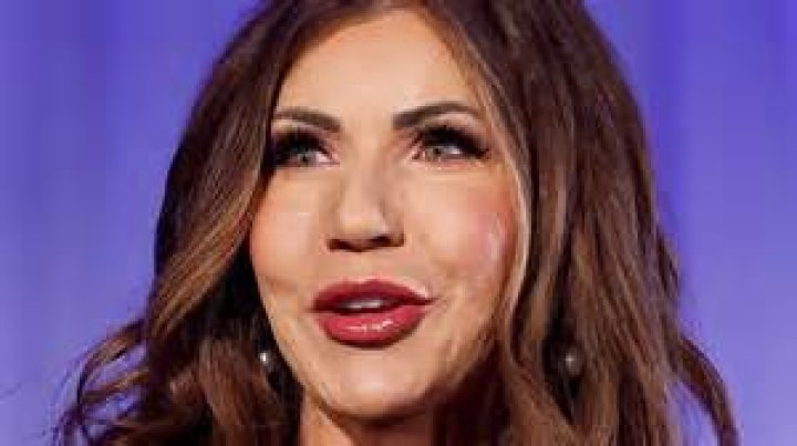 Kristi Noem's Plastic Surgery: Before And After Photos