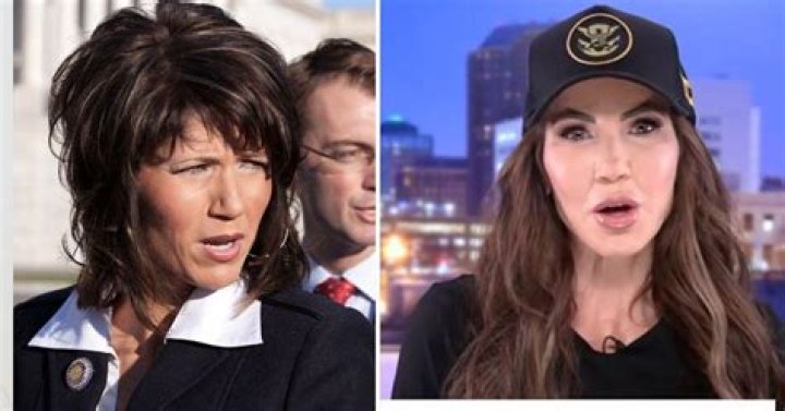 The Truth About Kirstie Noem's Plastic Surgery Rumors