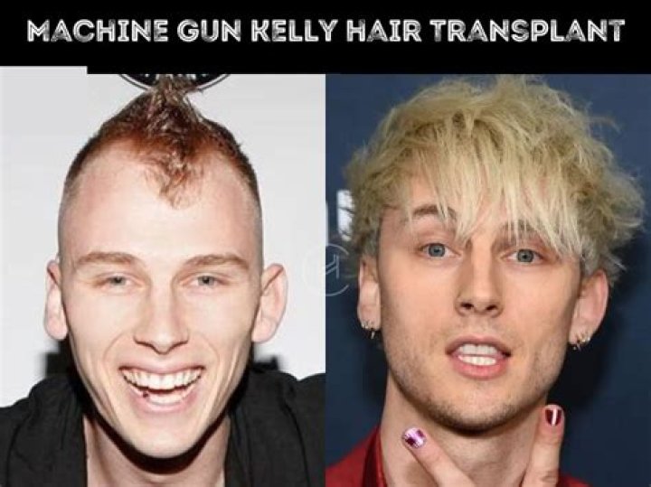 Machine Gun Kelly Age: Unlocking His Youthful Secrets