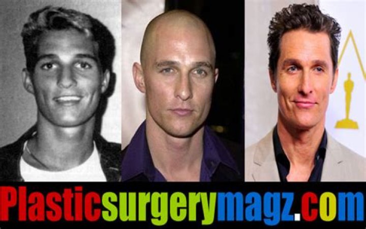 Matthew McConaughey's Guide To Plastic Surgery: Unlocking Youthful Beauty