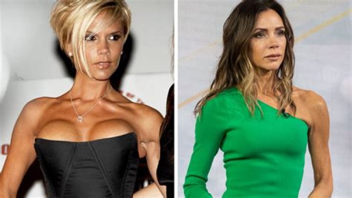 Unveiling Nicole Richie's Breast Augmentation Journey: Discoveries And Insights