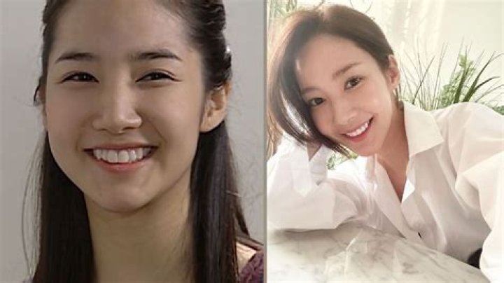 Unraveling Park Min Young's Plastic Surgery Journey: A Comprehensive Guide