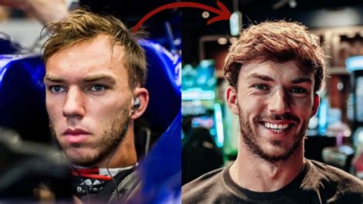Unveiling Pierre Gasly's Trademark Hairline