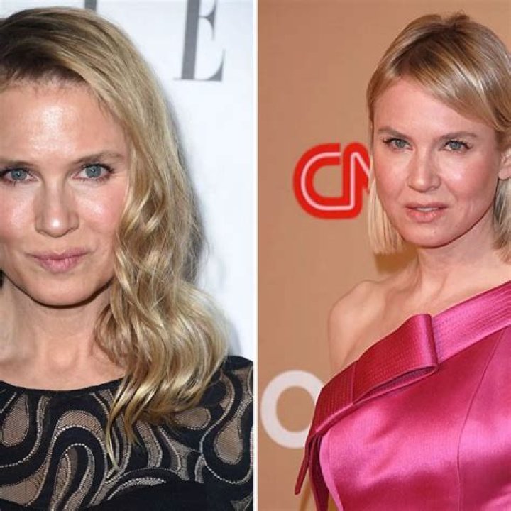 Renee Zellweger's Transformation: A Then And Now Photo Comparison