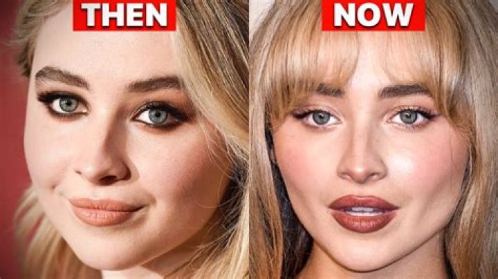 The Transformation Of Sabrina Carpenter: Before And After Fillers Revealed