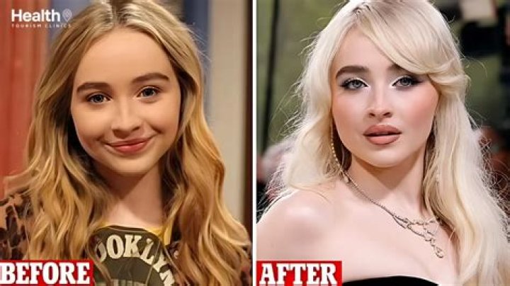 The Unmasking: Sabrina Carpenter's Surgical Transformation