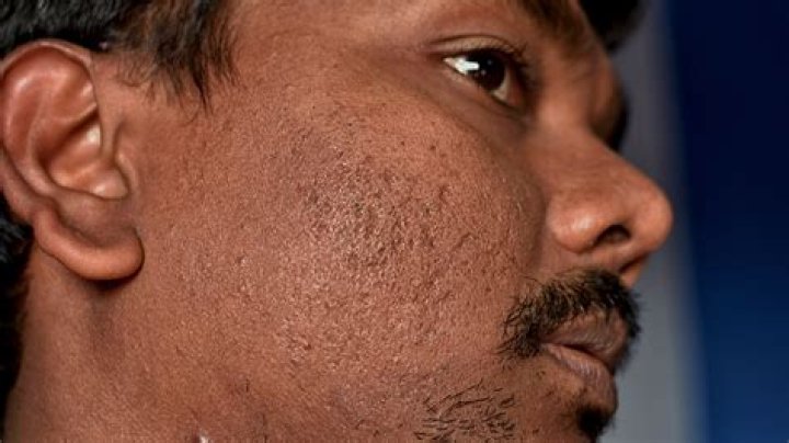 Why Do Seals Have Cheek Scars? An Unforgettable Guide