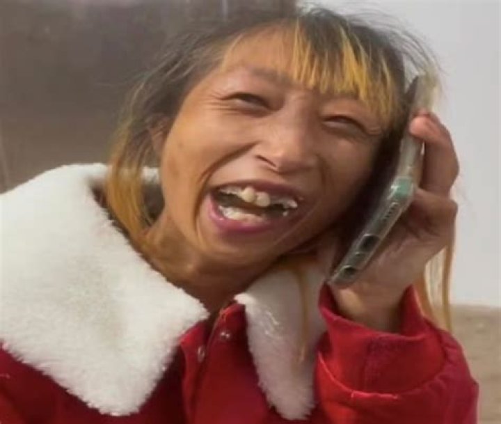 Understanding Xiao Xiao Disability AVM