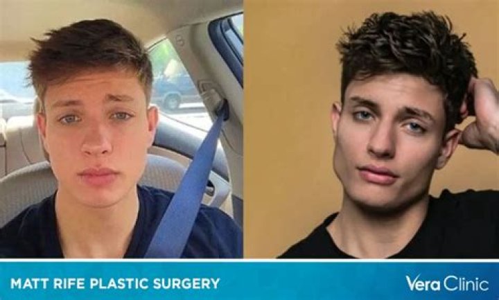Weight Loss And Plastic Surgery Revealed
